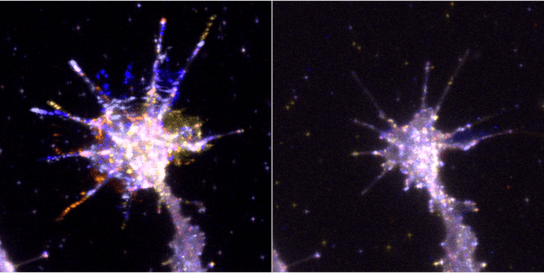 Talk: Membrane adaptor protein TOCA-1 interacts with Ena to drive filopodial protrusion